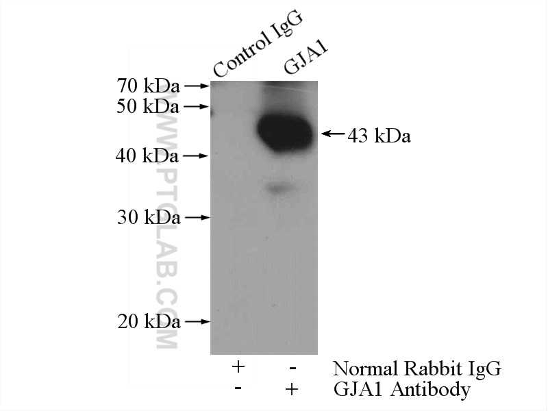 IP experiment of mouse heart using 15386-1-AP