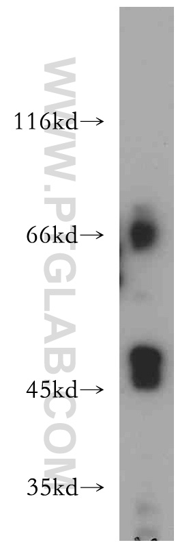 WB analysis of HeLa using 15386-1-AP