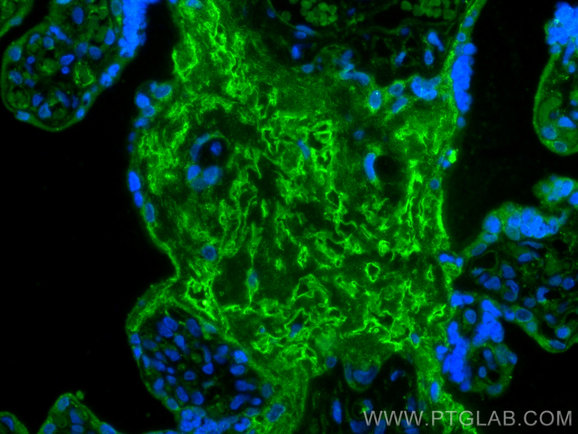 IF Staining of human placenta using 12880-1-AP