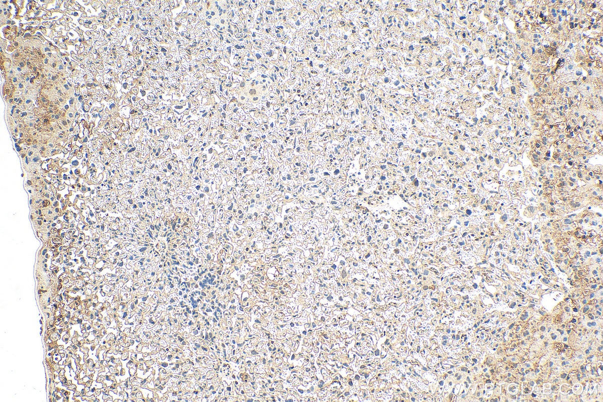IHC staining of mouse placenta using 12880-1-AP