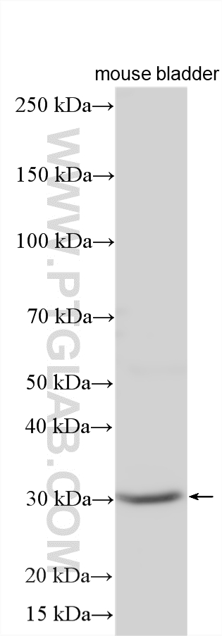 WB analysis using 12880-1-AP WB analysis using 12880-1-AP