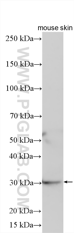 WB analysis using 12880-1-AP WB analysis using 12880-1-AP