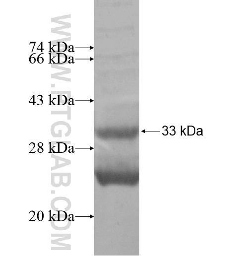 GJB4 fusion protein Ag14252 SDS-PAGE GJB4 fusion protein Ag14252 SDS-PAGE
