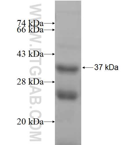 GJB5 fusion protein Ag8454 SDS-PAGE GJB5 fusion protein Ag8454 SDS-PAGE