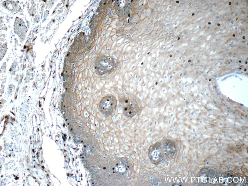 IHC staining of human oesophagus using 24215-1-AP