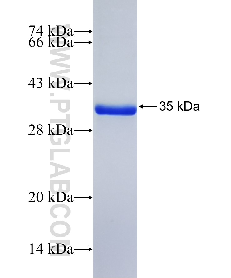 GJD3 fusion protein Ag41358 SDS-PAGE GJD3 fusion protein Ag41358 SDS-PAGE