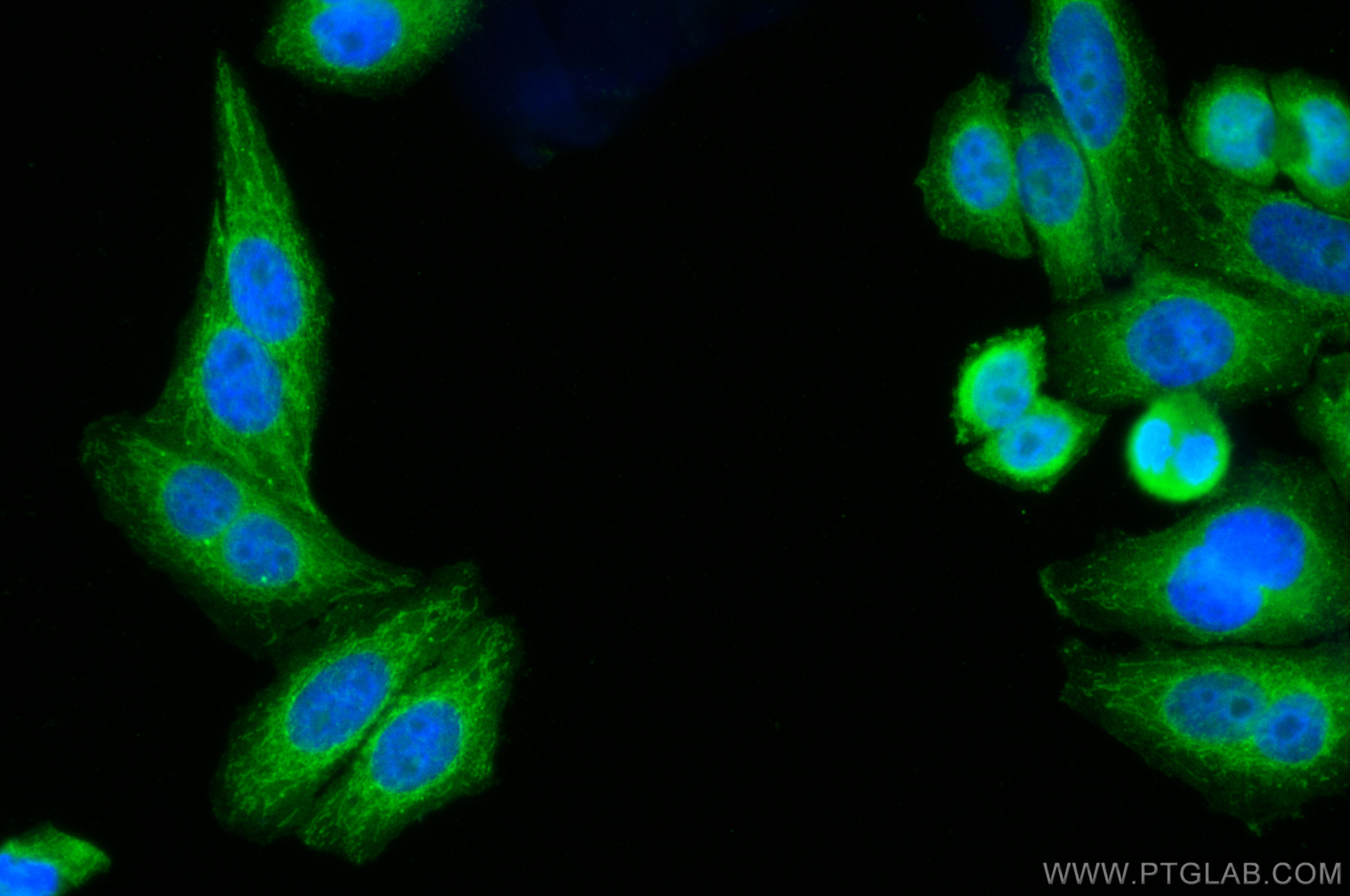 IF Staining of HepG2 using 13360-1-AP