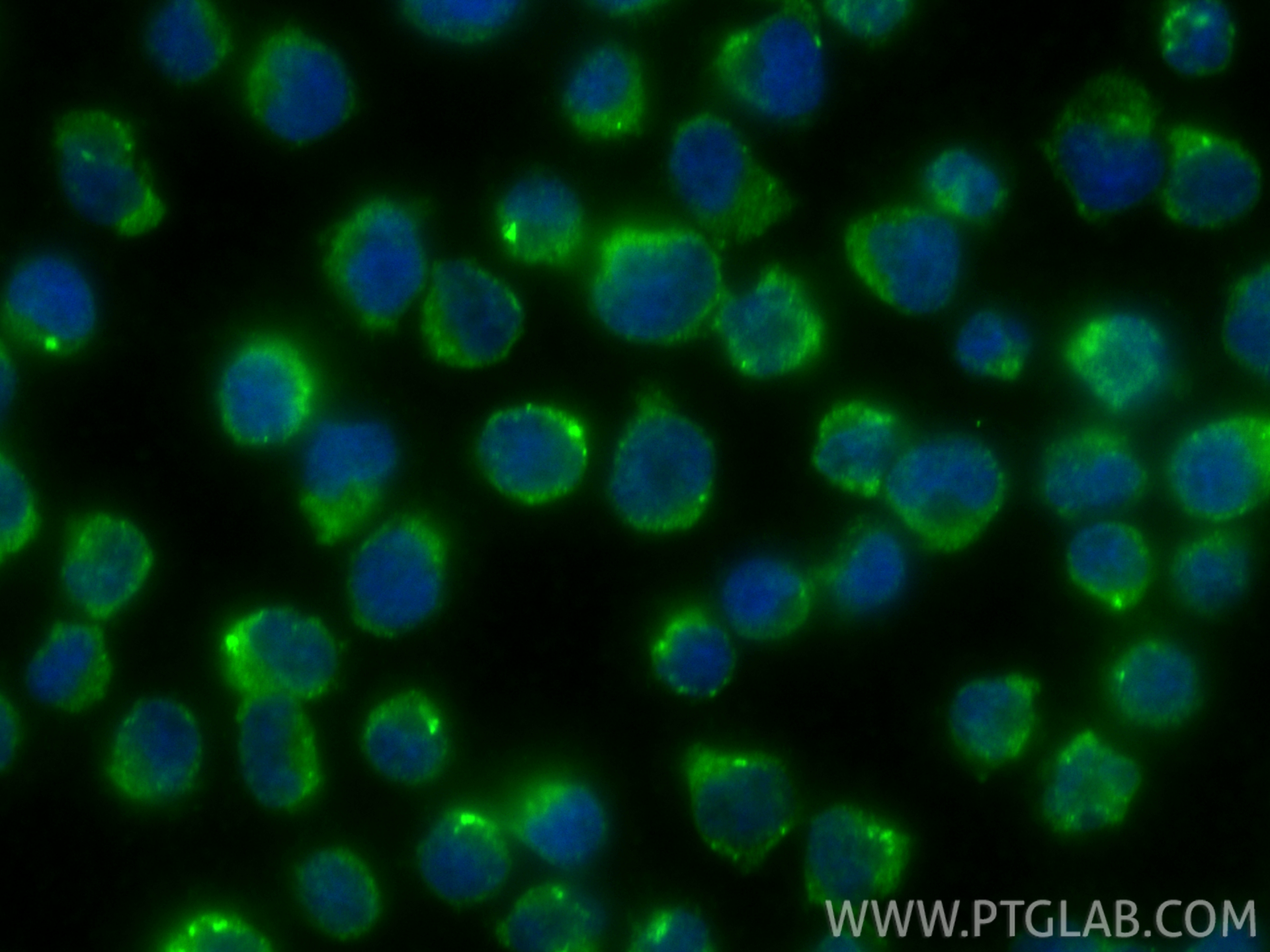 IF Staining of Jurkat using 13457-1-AP IF Staining of Jurkat using 13457-1-AP