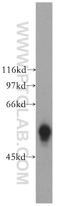 WB analysis of Jurkat using 13457-1-AP