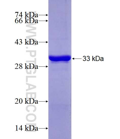 GK5 fusion protein Ag28536 SDS-PAGE GK5 fusion protein Ag28536 SDS-PAGE