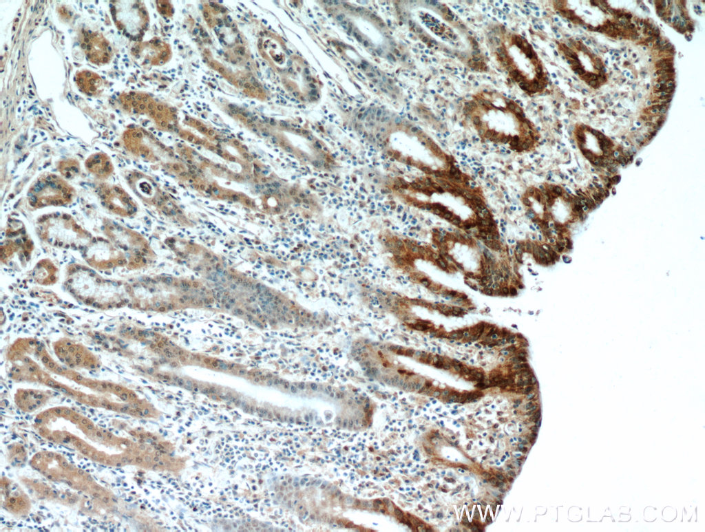 IHC staining of human stomach using 14494-1-AP