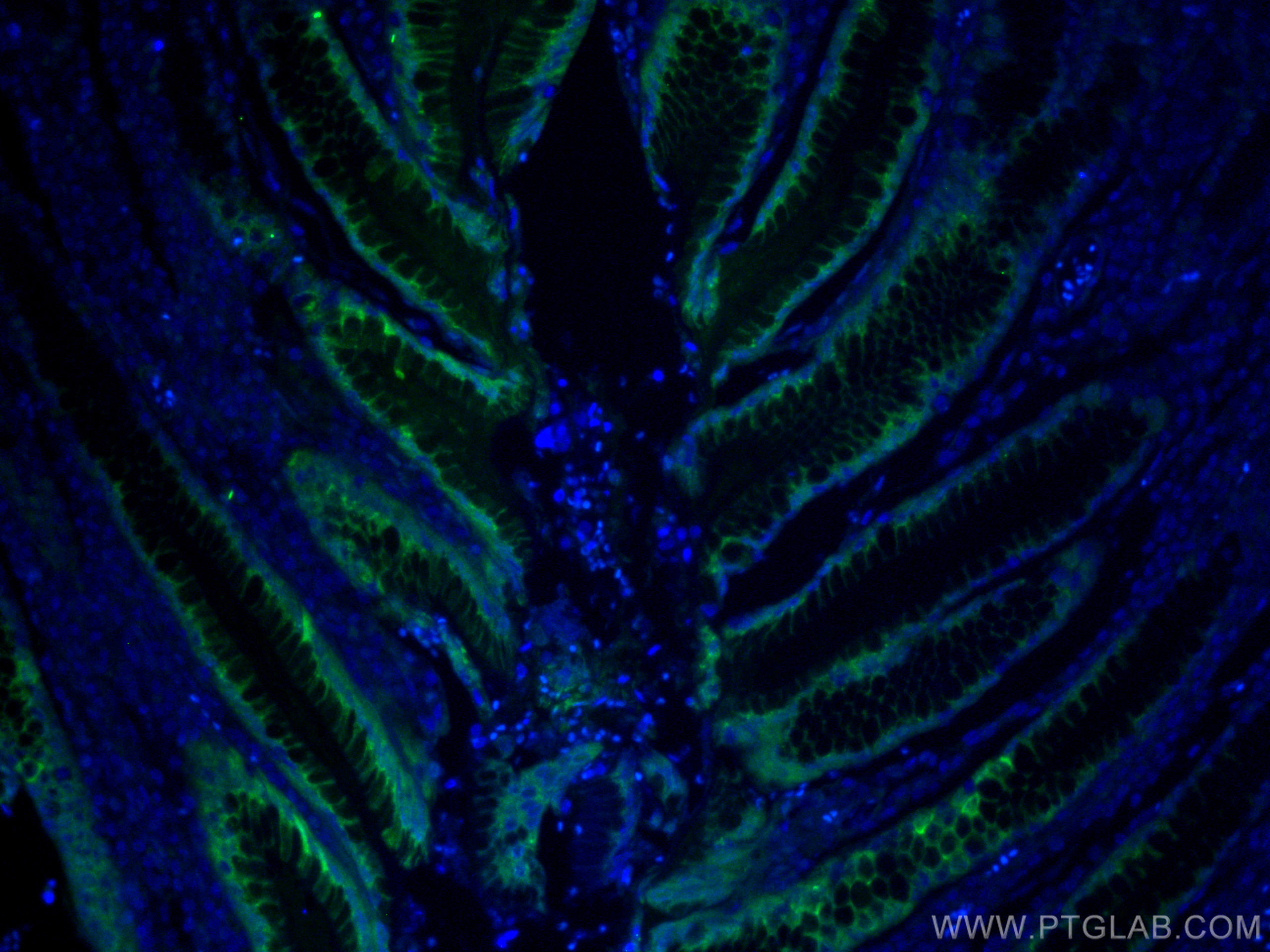 IF Staining of human stomach using 60130-1-Ig (same clone as 60130-1-PBS)