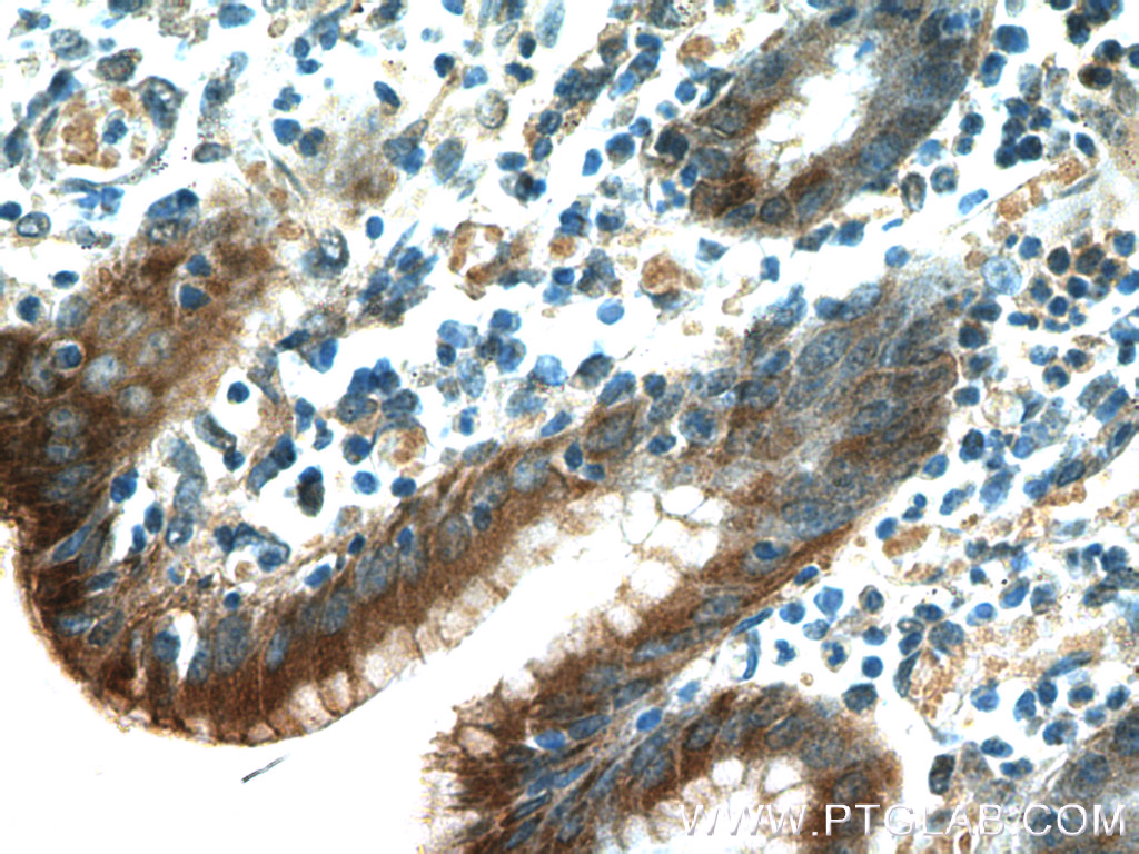 IHC staining of human stomach using 60130-1-Ig (same clone as 60130-1-PBS)