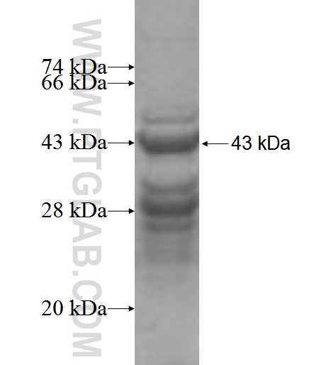 GKN1 fusion protein Ag5898 SDS-PAGE