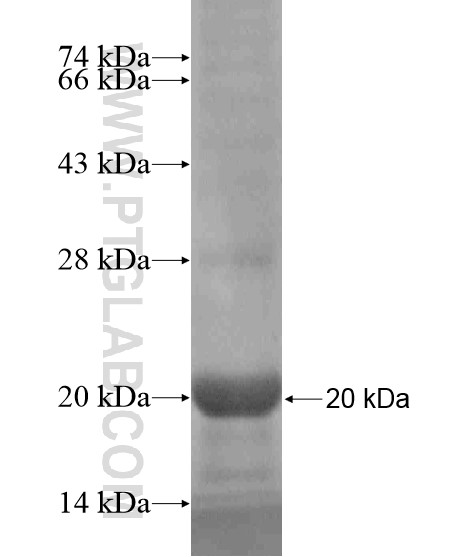 GKN2 fusion protein Ag19043 SDS-PAGE