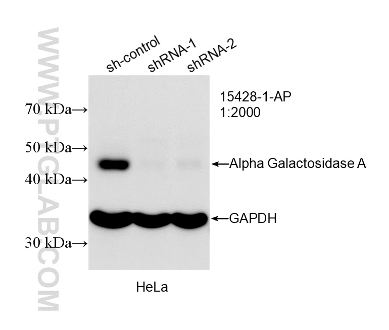WB analysis of HeLa using 15428-1-AP WB analysis of HeLa using 15428-1-AP