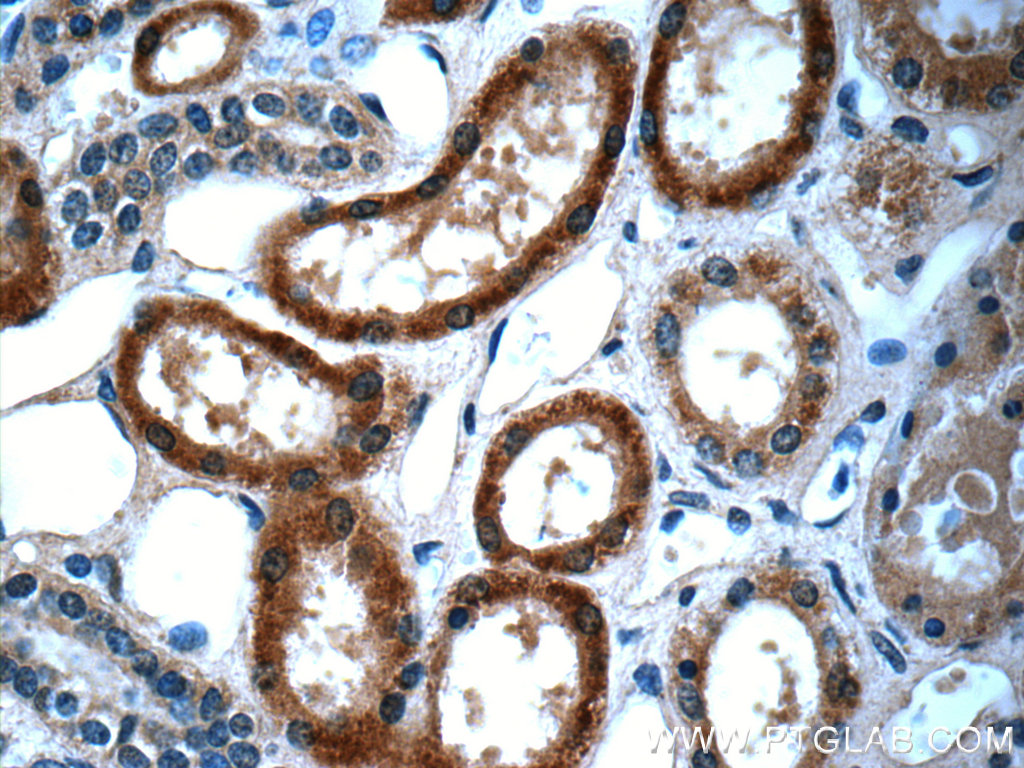 IHC staining of human kidney using 66121-1-Ig