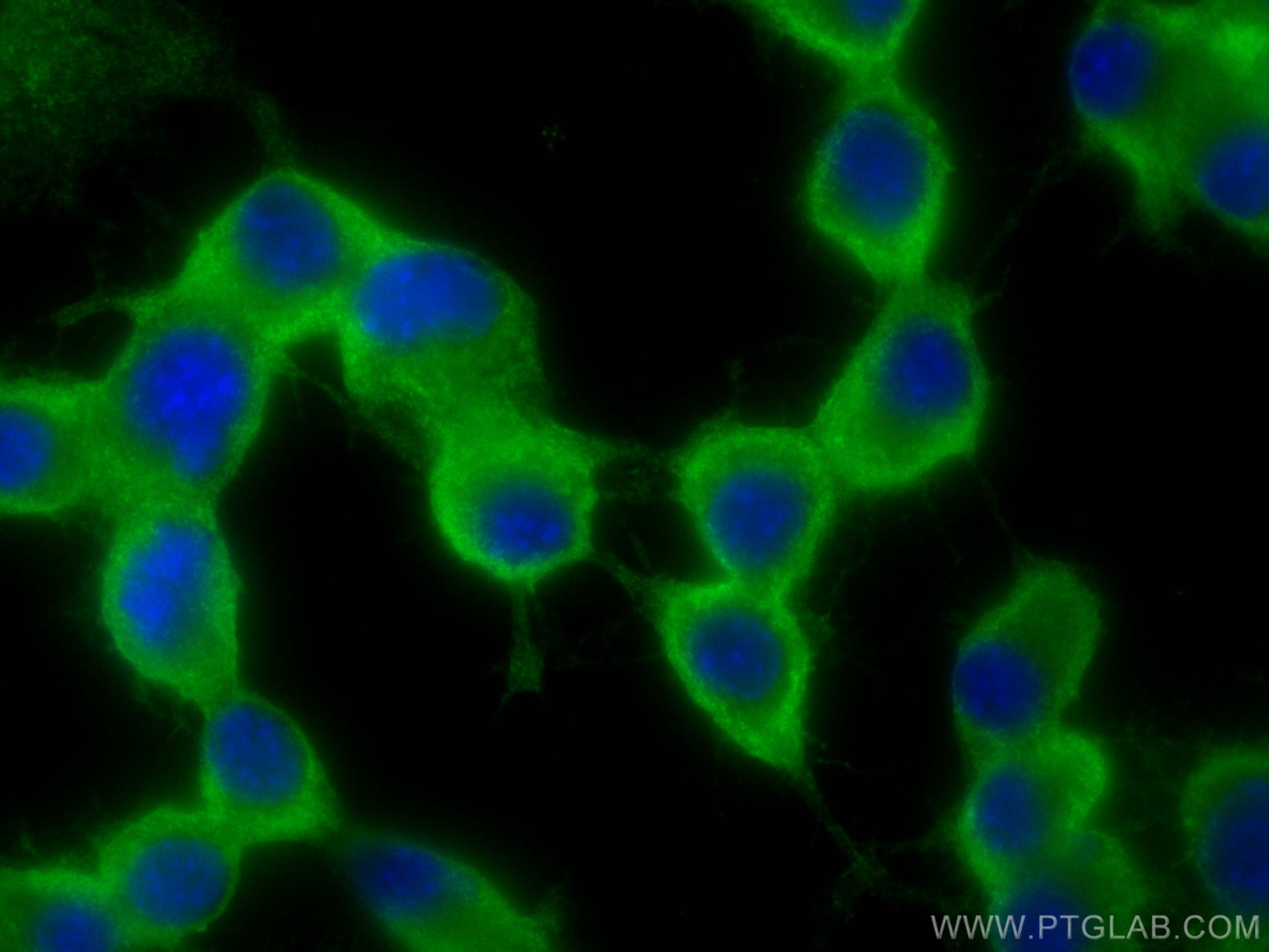 IF Staining of Neuro-2a using 20785-1-AP