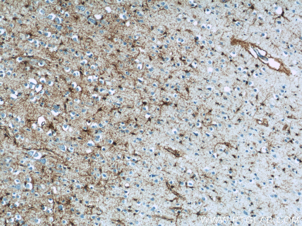 IHC staining of human brain using 20785-1-AP