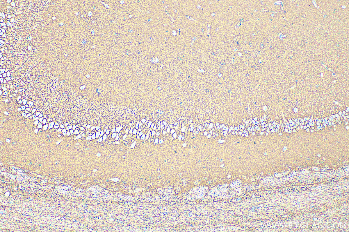 Immunohistochemical analysis of paraffin-embedded rat brain tissue slide using 20785-1-AP (GLAST/EAAT1 antibody) at dilution of 1:400 (under 10x lens). Heat mediated antigen retrieval with Tris-EDTA buffer (pH 9.0). IHC staining of rat brain using 20785-1-AP