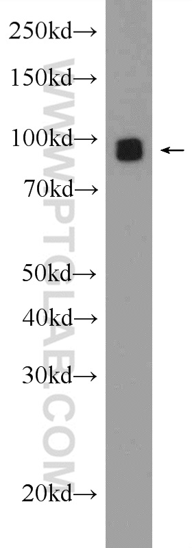 WB analysis of Neuro-2a using 20785-1-AP