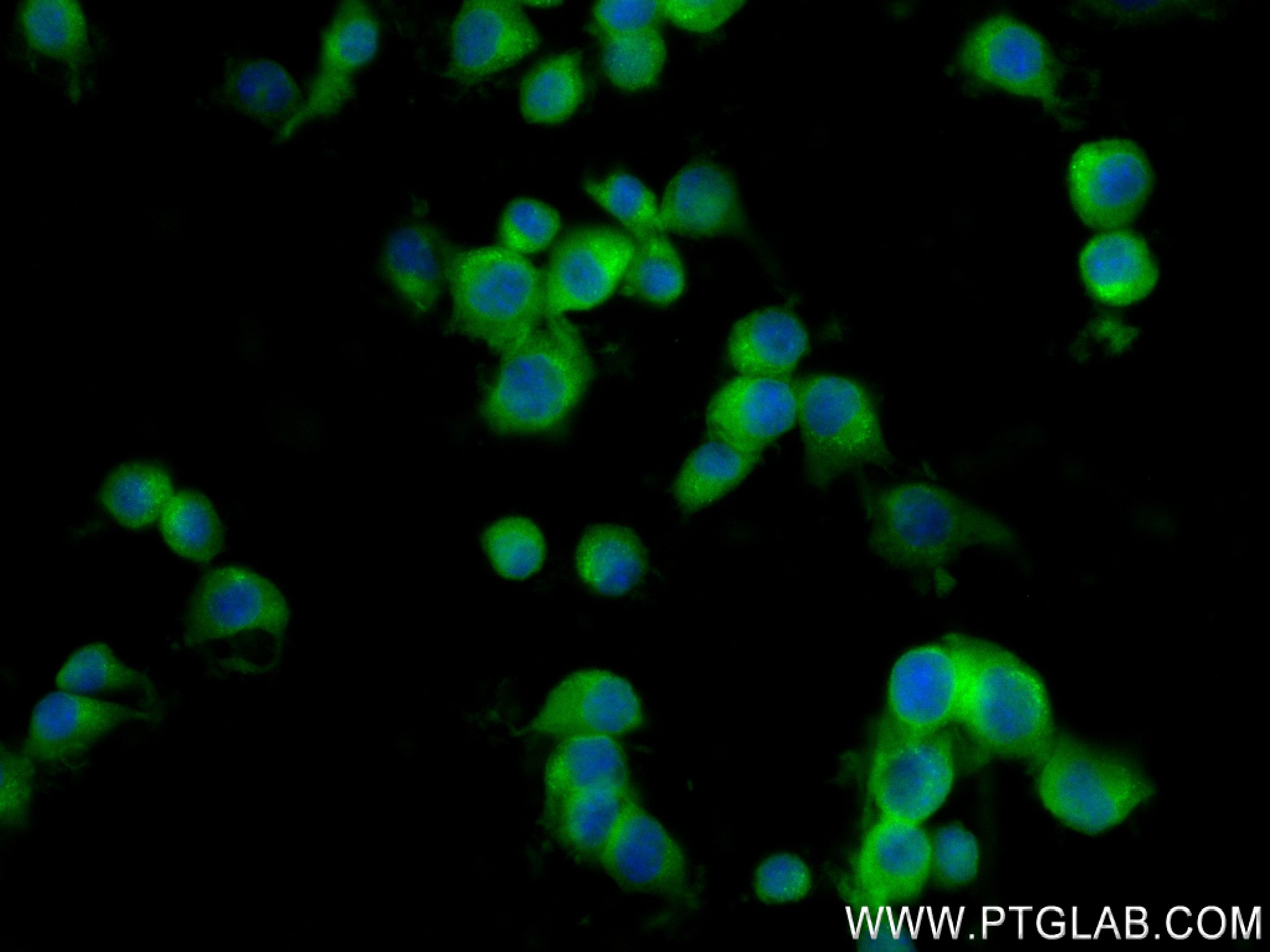 Immunofluorescent analysis of (4% PFA) fixed Neuro-2a cells using GLAST antibody (84497-4-RR, Clone: 241907H3 ) at dilution of 1:250 and CoraLite®488-Conjugated Goat Anti-Rabbit IgG(H+L) (<a class='green' href='/productredirect?CatalogNo=SA00013-2' target='_blank'>SA00013-2</a>). IF Staining of Neuro-2a using 84497-4-RR