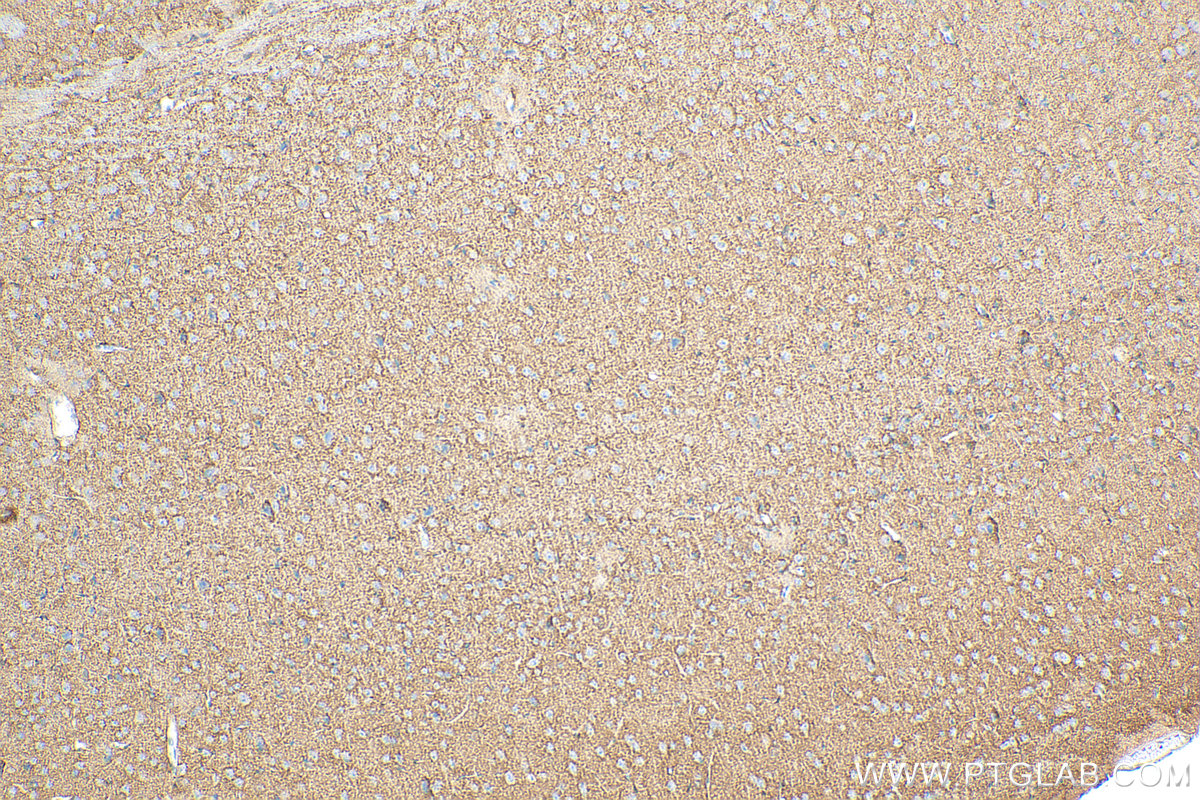 Immunohistochemical analysis of paraffin-embedded mouse brain tissue slide using Biotin-20785 (GLAST/EAAT1 antibody) at dilution of 1:200 (under 10x lens). Heat mediated antigen retrieval with Tris-EDTA buffer (pH 9.0). IHC staining of mouse brain using Biotin-20785