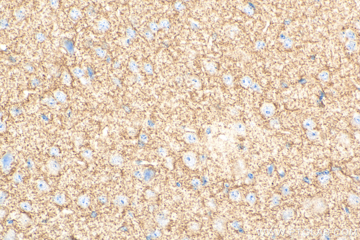 Immunohistochemical analysis of paraffin-embedded mouse brain tissue slide using Biotin-20785 (GLAST/EAAT1 antibody) at dilution of 1:200 (under 40x lens). Heat mediated antigen retrieval with Tris-EDTA buffer (pH 9.0). IHC staining of mouse brain using Biotin-20785
