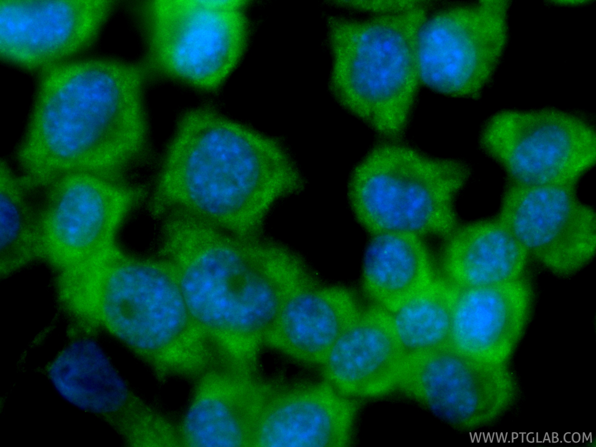 IF Staining of Neuro-2a using CL488-84497-4
