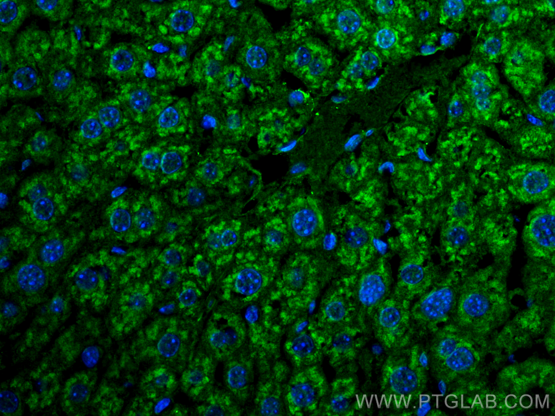 IF Staining of mouse liver using 15518-1-AP