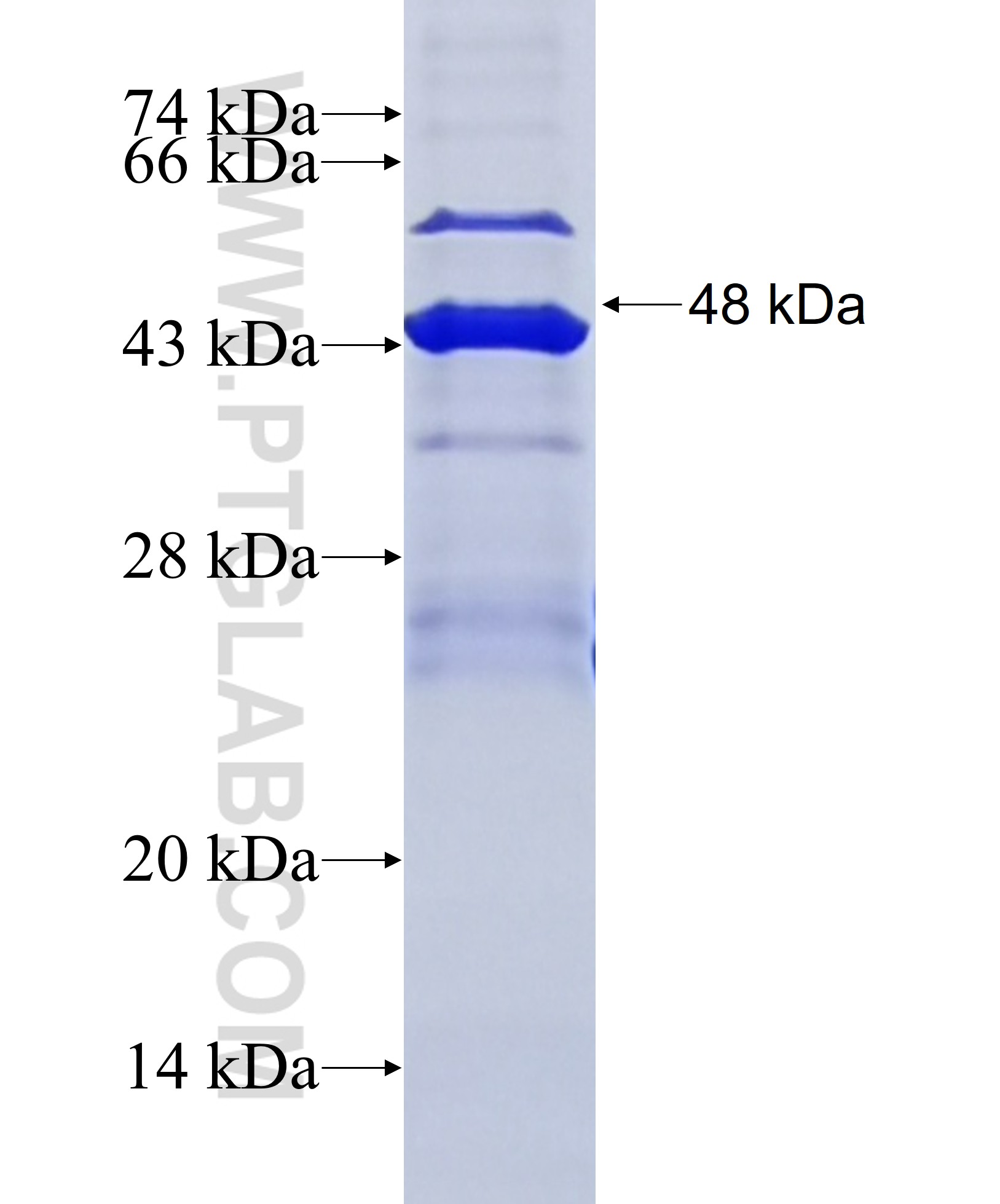 GLB1L2 fusion protein Ag36047 SDS-PAGE GLB1L2 fusion protein Ag36047 SDS-PAGE