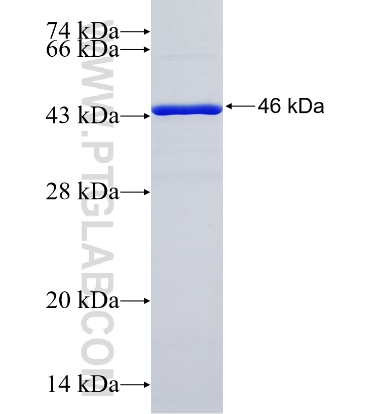 GLCCI1 fusion protein Ag35682 SDS-PAGE GLCCI1 fusion protein Ag35682 SDS-PAGE