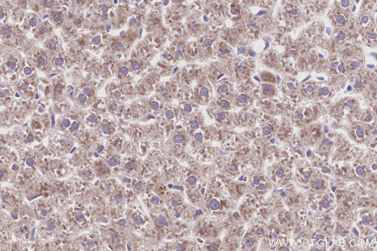 IHC staining of rat liver using 86378-1-RR IHC staining of rat liver using 86378-1-RR