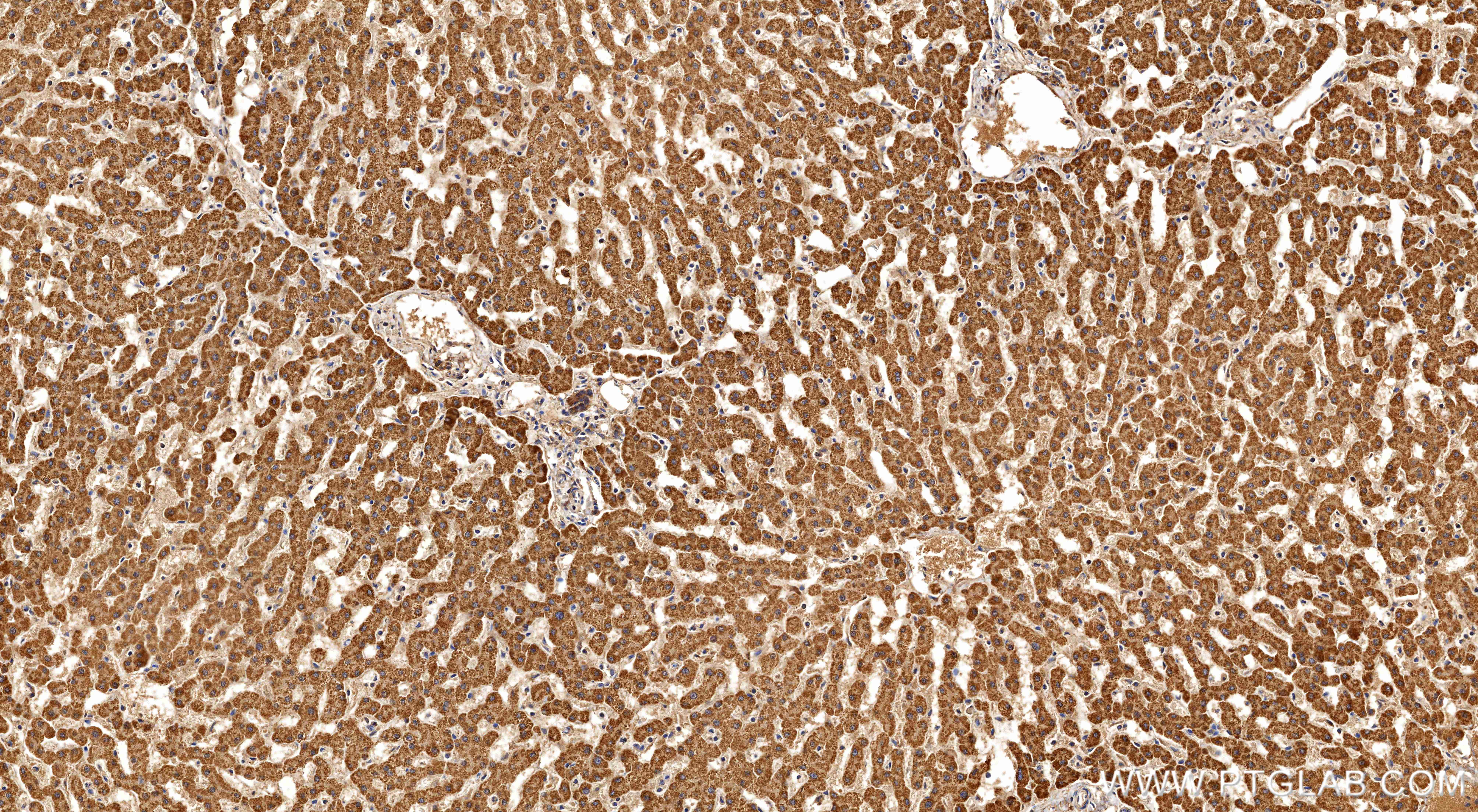 IHC staining of human liver using 86378-1-RR IHC staining of human liver using 86378-1-RR