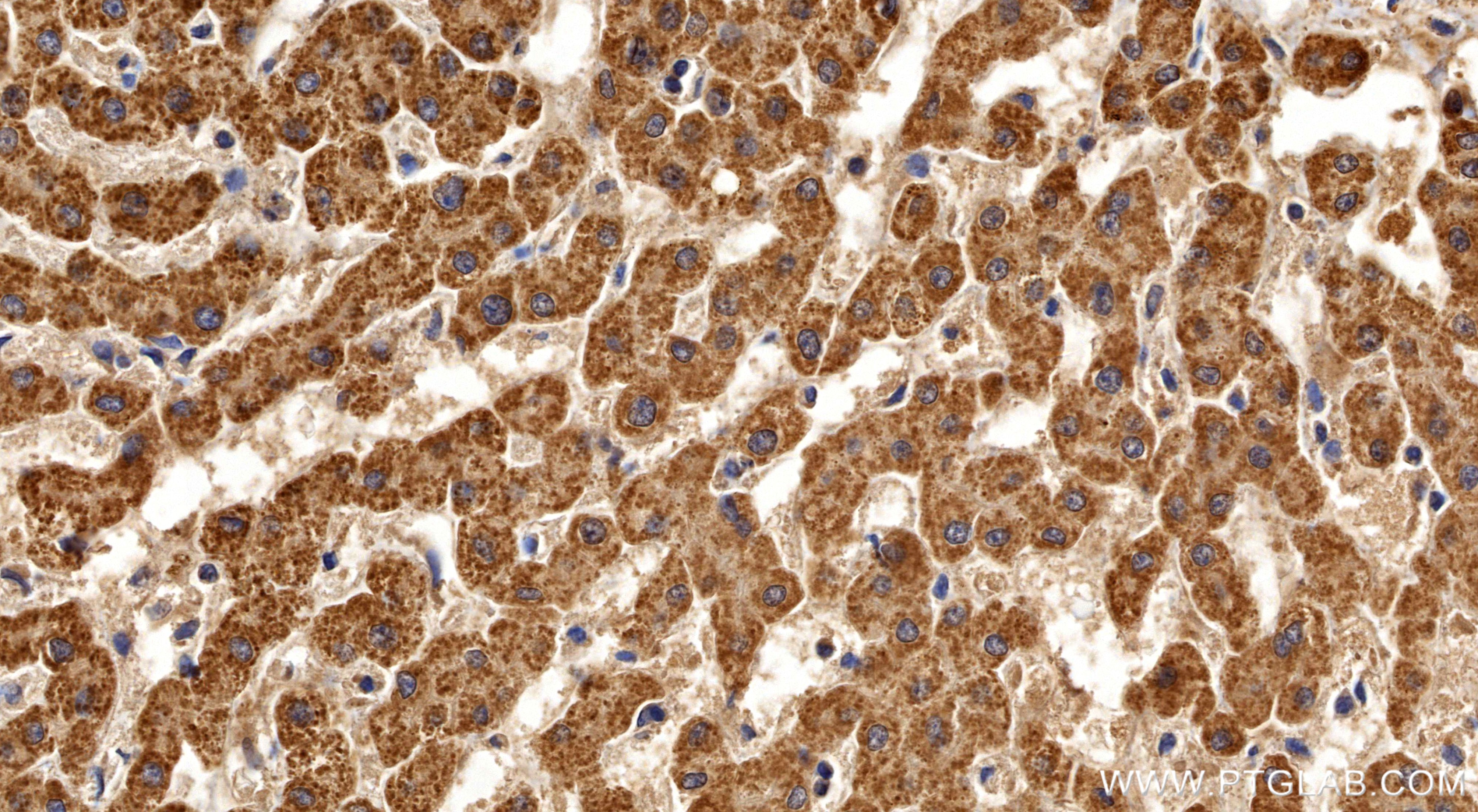 IHC staining of human liver using 86378-1-RR IHC staining of human liver using 86378-1-RR