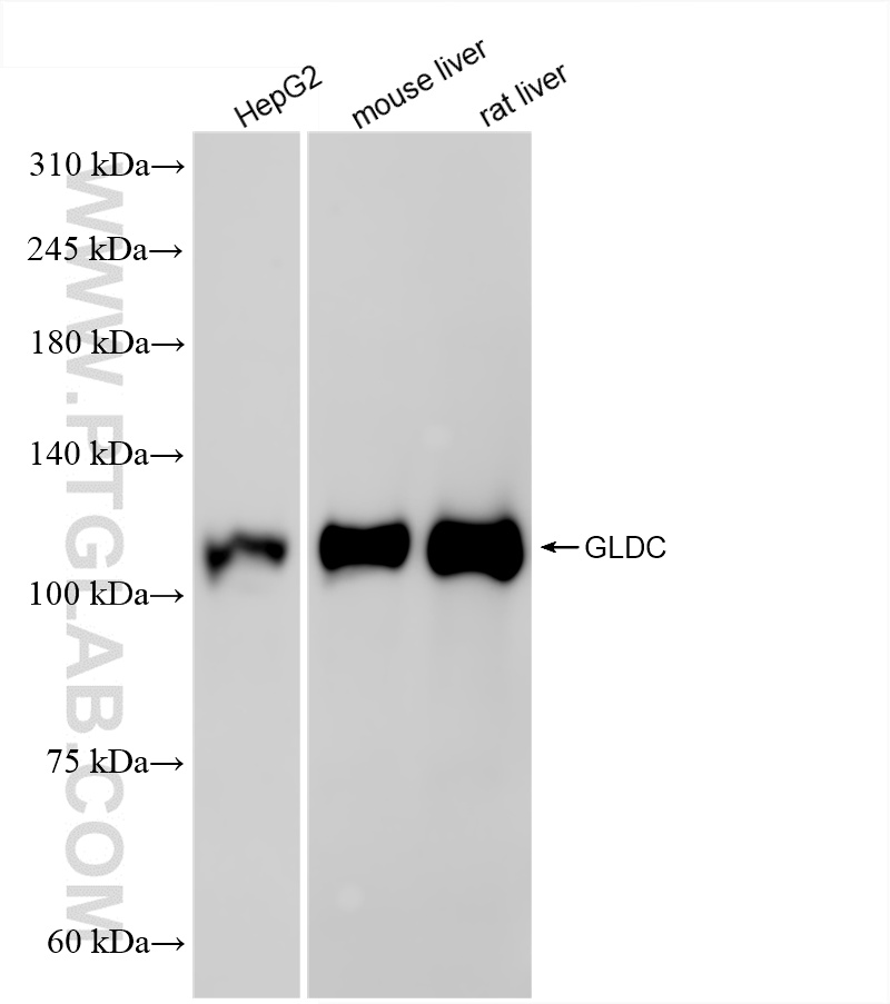 Various lysates were subjected to SDS PAGE followed by western blot with 86378-1-RR (GLDC antibody) at dilution of 1:10000 incubated at room temperature for 1.5 hours. WB analysis using 86378-1-RR