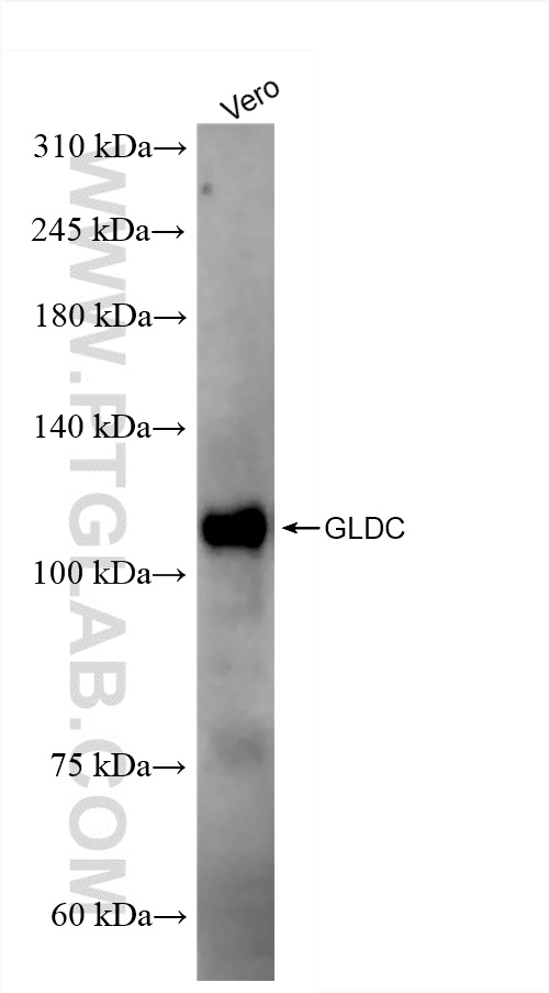 Vero cells were subjected to SDS PAGE followed by western blot with 86378-1-RR (GLDC antibody) at dilution of 1:10000 incubated at room temperature for 1.5 hours. WB analysis of Vero using 86378-1-RR