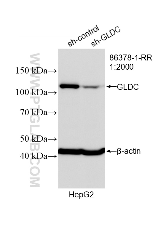 WB analysis of HepG2 using 86378-1-RR WB analysis of HepG2 using 86378-1-RR