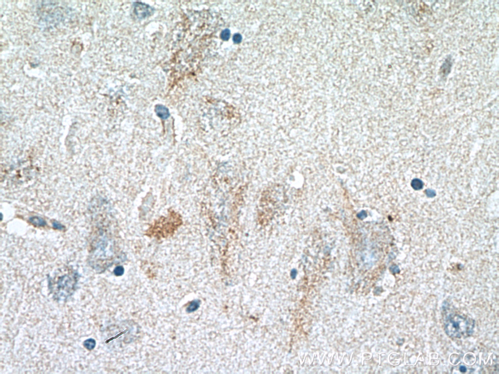 IHC staining of human brain using 26185-1-AP