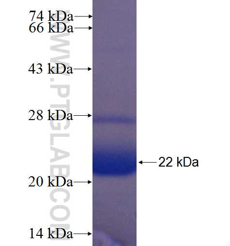 GLE1 fusion protein Ag24275 SDS-PAGE GLE1 fusion protein Ag24275 SDS-PAGE