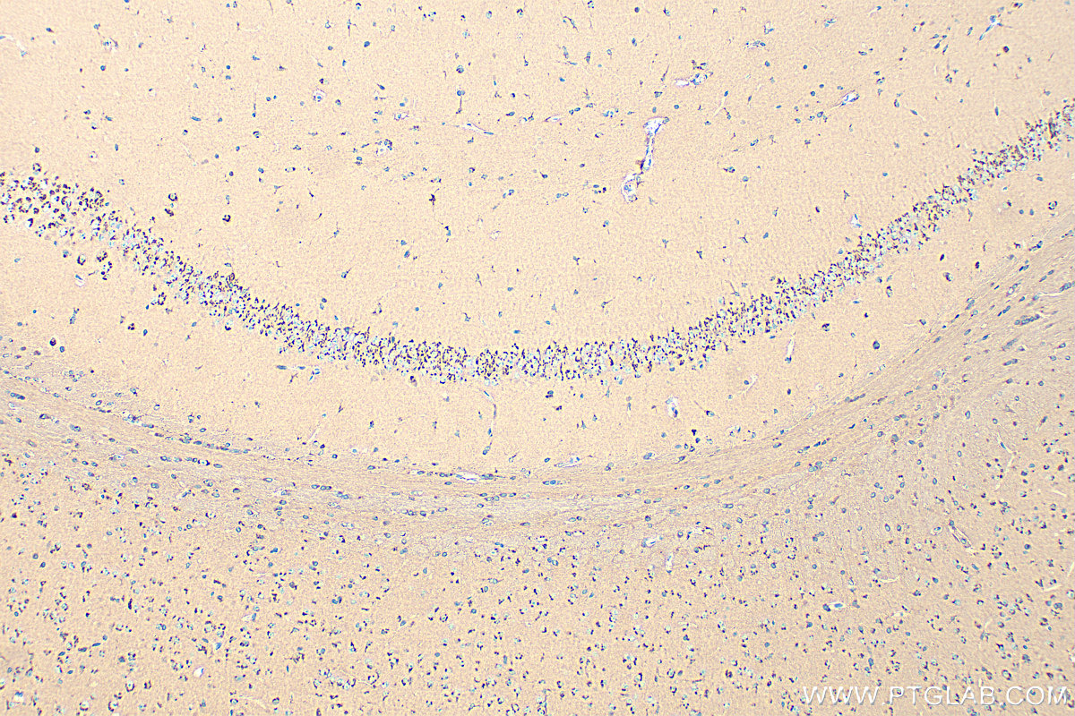 IHC staining of mouse brain using 34250-1-AP IHC staining of mouse brain using 34250-1-AP