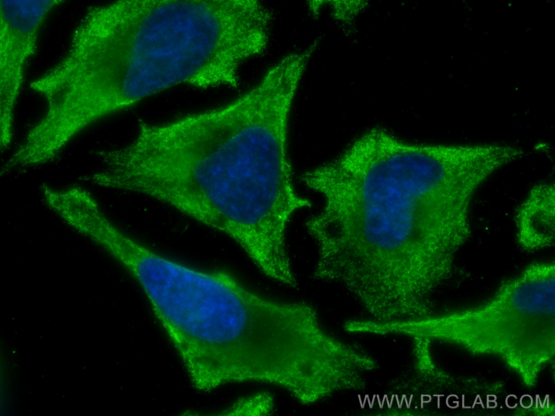 IF Staining of HeLa using 66905-1-Ig