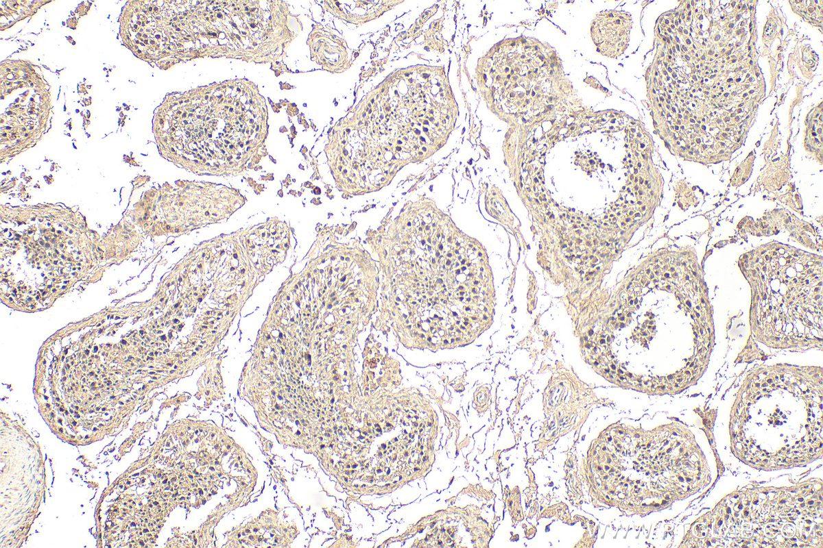 IHC staining of human testis using 66905-1-Ig