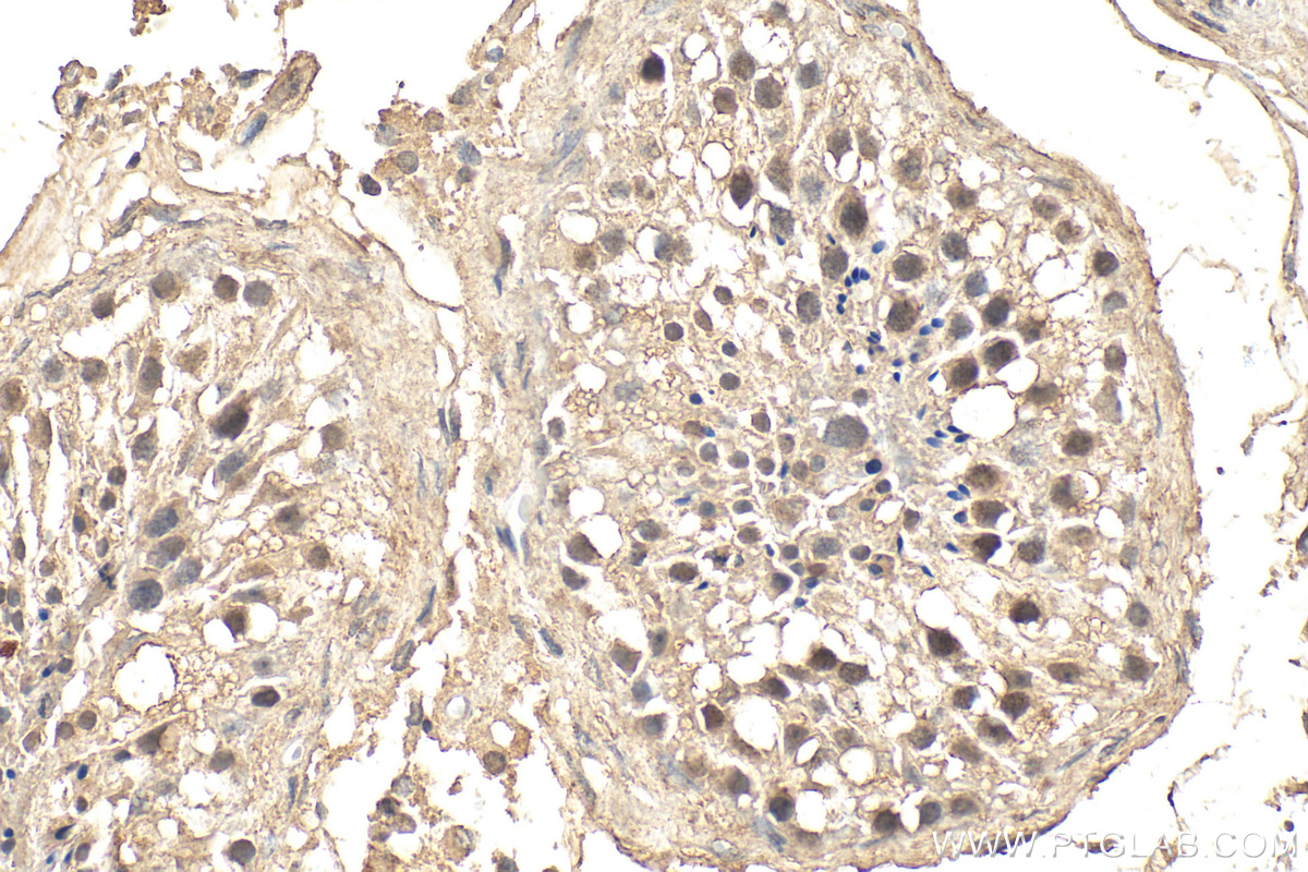 IHC staining of human testis using 66905-1-Ig