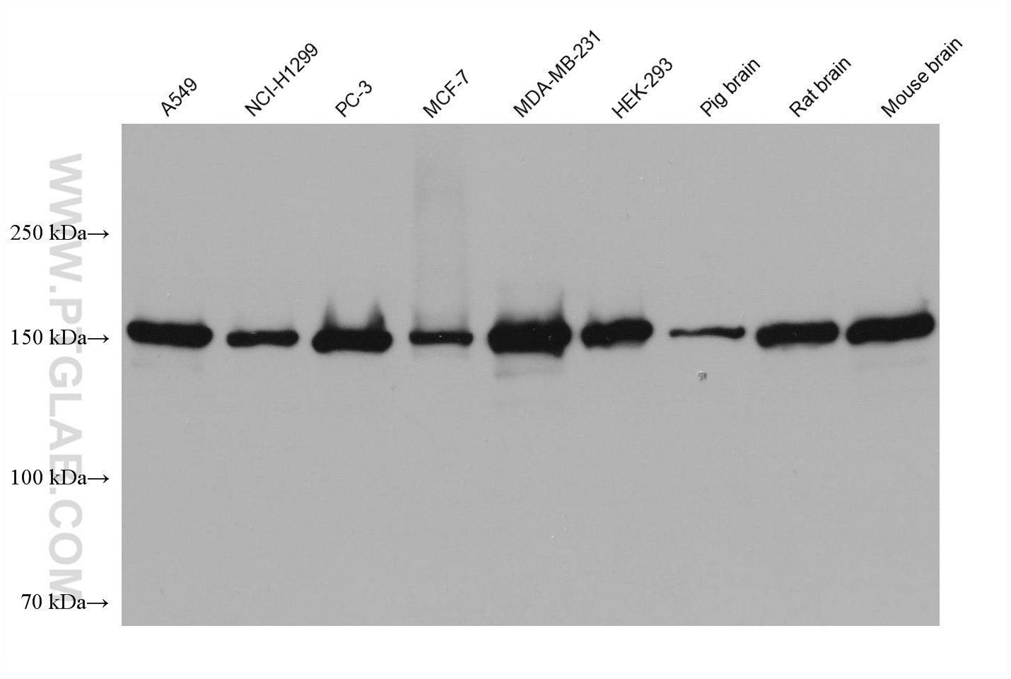 WB analysis using 66905-1-Ig (same clone as 66905-1-PBS)