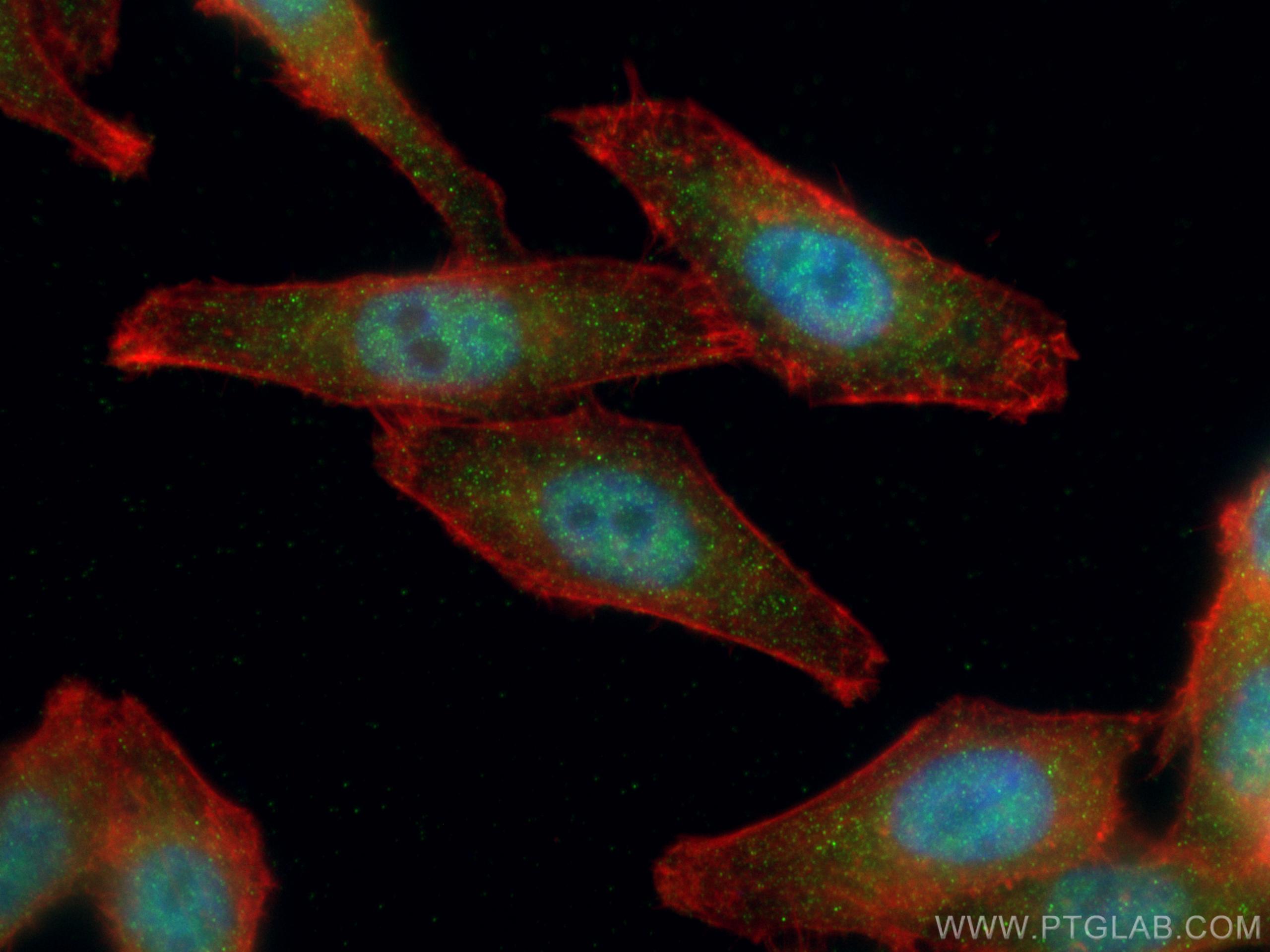 IF Staining of HepG2 using 18989-1-AP