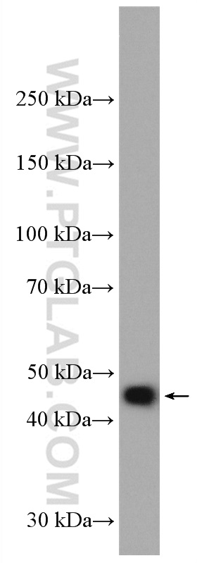 WB analysis of Jurkat using 16551-1-AP