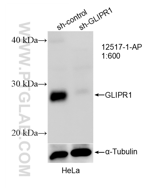 WB result of GLIPR1 antibody (12517-1-AP; 1:600; incubated at room temperature for 1.5 hours) with sh-Control and sh-GLIPR1 transfected HeLa cells. WB analysis of HeLa using 12517-1-AP