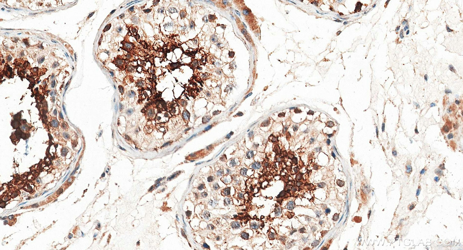IHC staining of human testis using 20828-1-AP IHC staining of human testis using 20828-1-AP