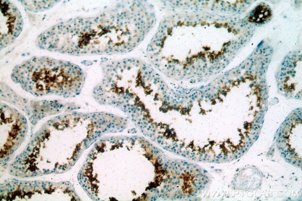 IHC staining of human testis using 20828-1-AP